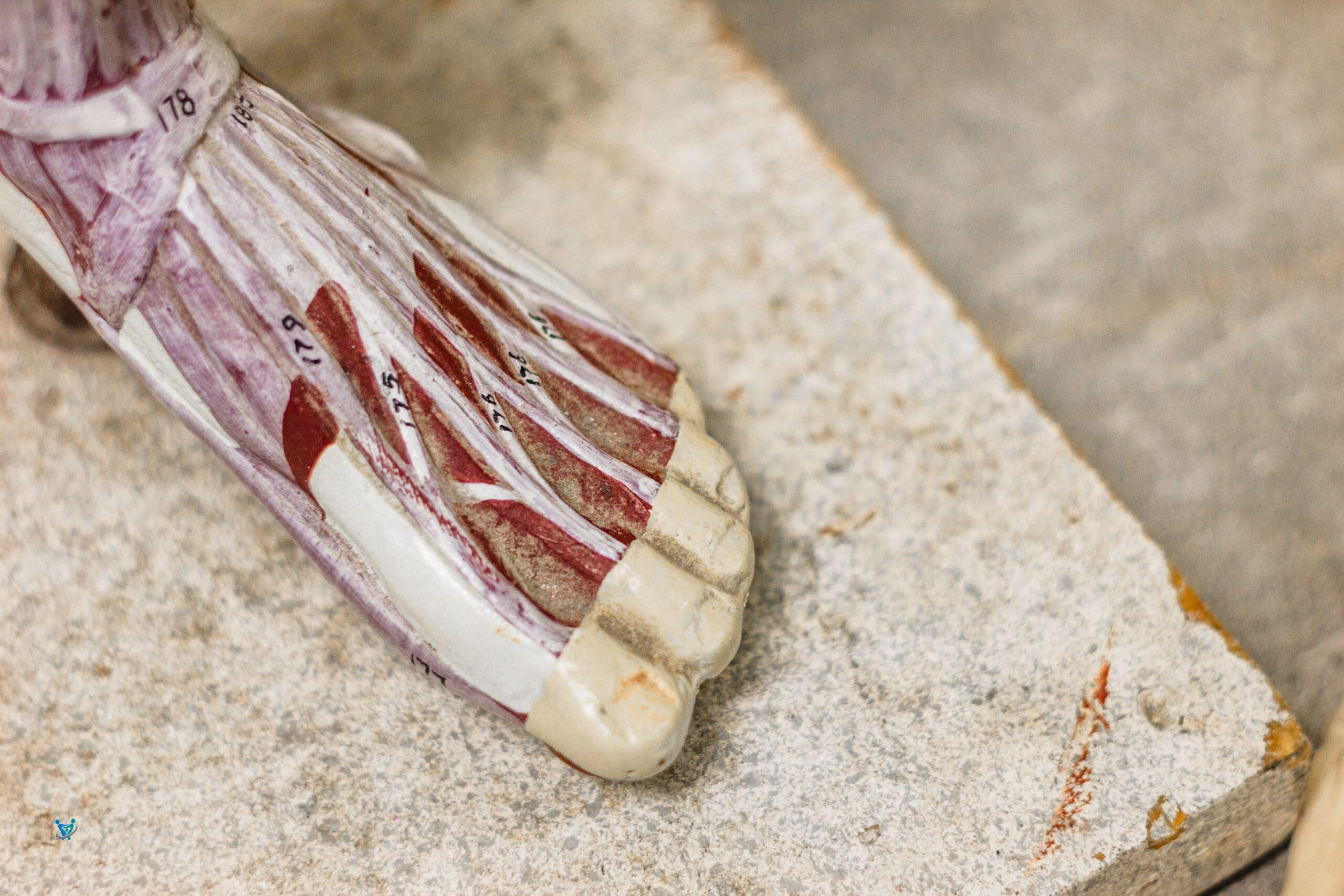 مدة علاج قطع الرباط الصليبي 1 مدة علاج قطع الرباط الصليبي